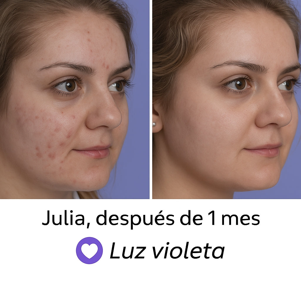 Máscara facial LED
