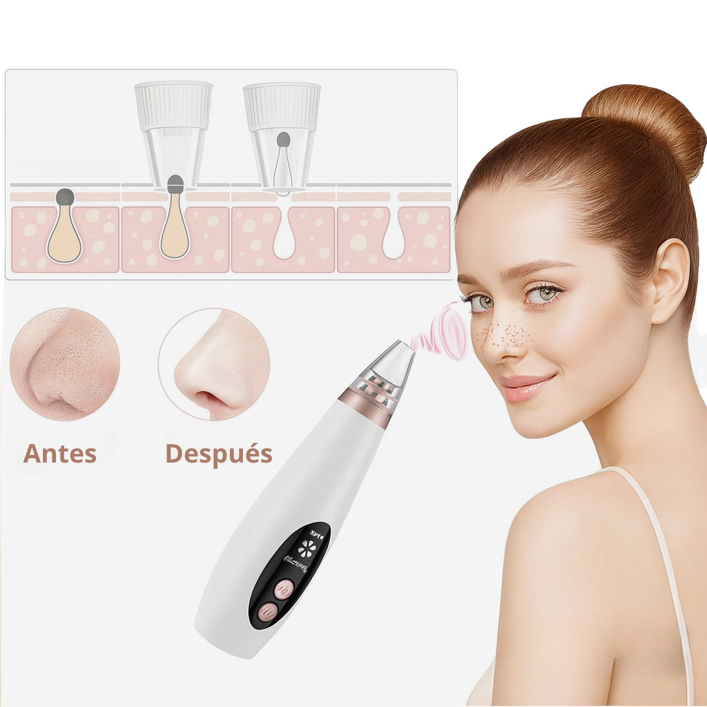 Succionador de poros